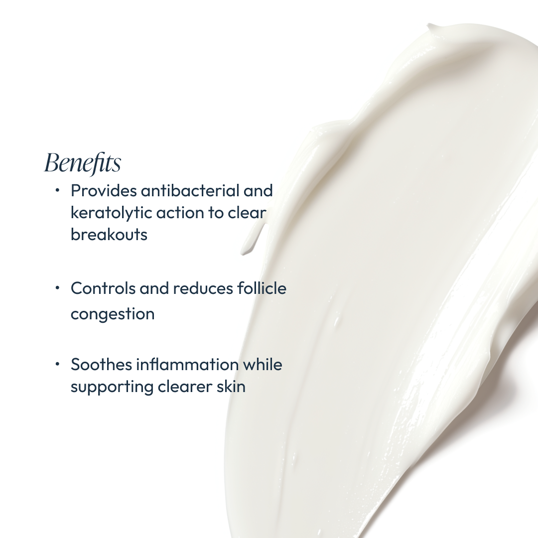 Nighttime Control Acne Treatment Lotion