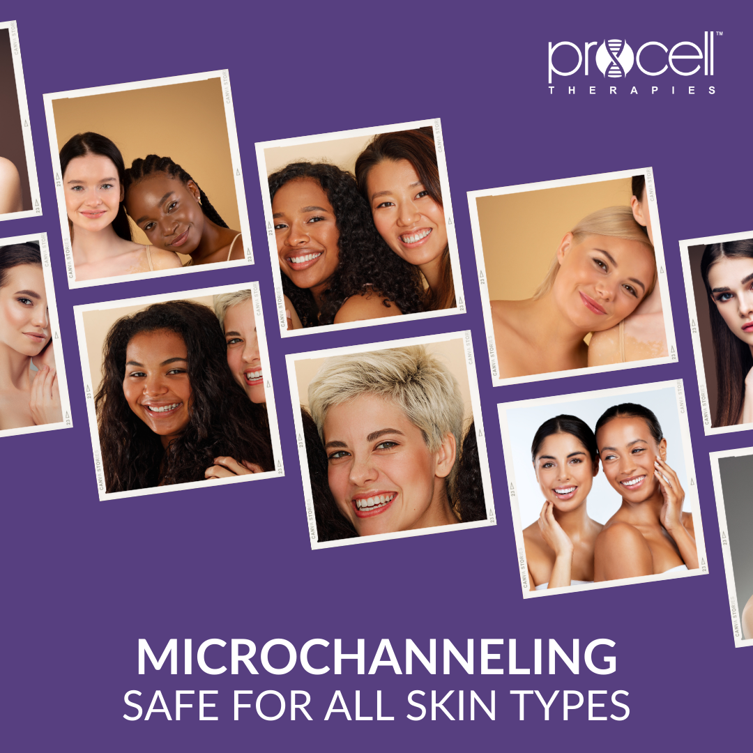 Microchanneling Packages